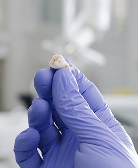 Hand holding an extracted tooth