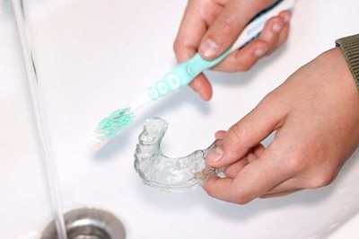 A nightguard being cleaned with a soft-bristled toothbrush