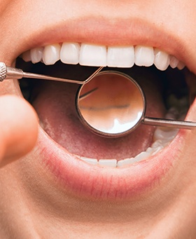 Dentist performing checkup on female patient