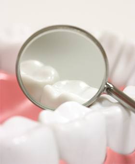 Closeup of smile during dental exam