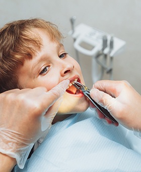 a child undergoing tooth extractions in Allen