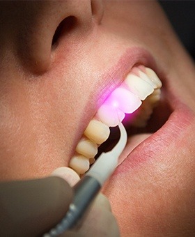 Closeup of patient receiving soft tissue laser treatment