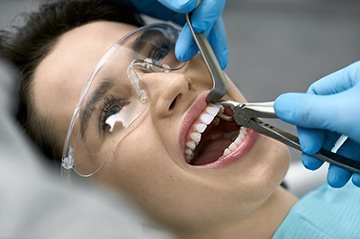 Factors that can affect the cost of tooth extraction include the location of tooth within your mouth