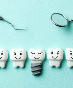 Illustration of dental implant in Mangum