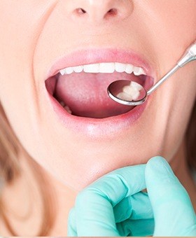 Closeup of patient receiving dental exm