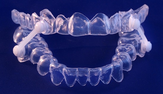 An oral appliance