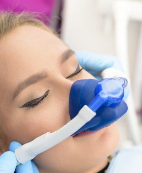 Patient with nitrous oxide nasal mask