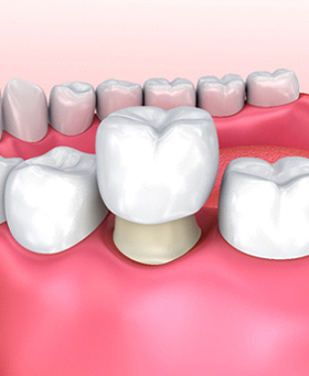 Intraoral Radiographic Anatomy