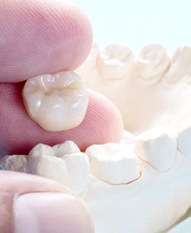 A dentist holding a ceramic dental crown next to a mouth mold