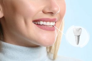 a woman getting dental implants placed as her front teeth