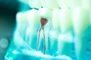3D render of a root canal