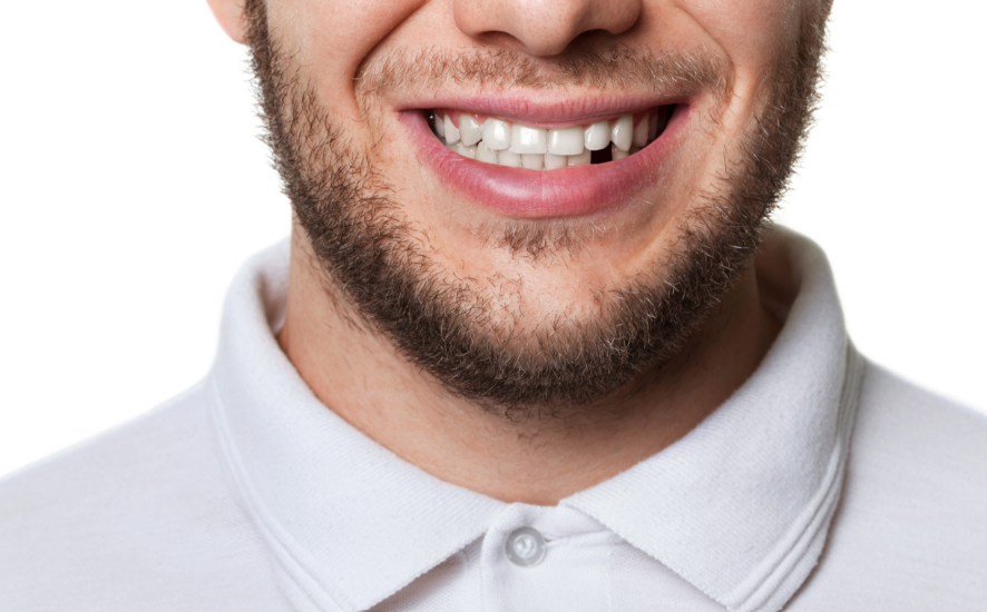 Man's smiling, missing tooth